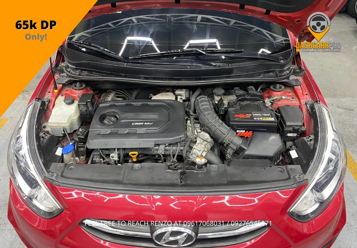 2016 Hyundai Accent Hatchback